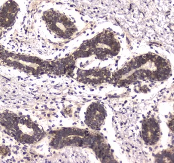 POLR2A Antibody / RPB1 - image 1