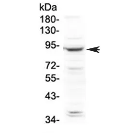 PLA2G6 Antibody / CaI-PLA2 - image 1