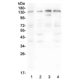 EPS15 Antibody / Epidermal growth factor receptor substrate 15 - image 1