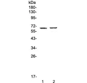 RUNX1T1 Antibody - image 1