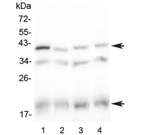 Baff receptor Antibody / Baff-r - image 1