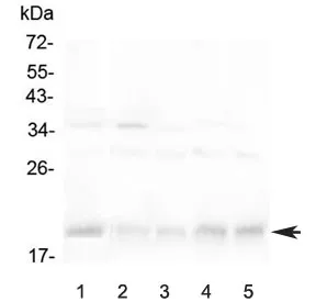 BAFF Receptor Antibody / BAFF-R - image 1