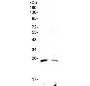 StAR Antibody / Steroidogenic acute regulatory protein - image 1