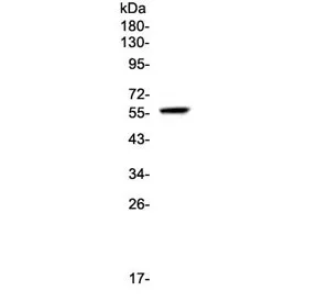 FGR Antibody / c-FGR proto oncogene - image 1