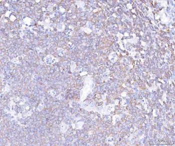 PLCG2 Antibody / Phosphoinositide phospholipase C gamma 2 - image 1
