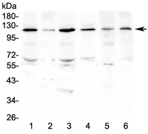 Platelet Derived Growth Factor Receptor beta Antibody / PDGFRB - image 1