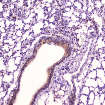 Leptin Antibody / LEP - image 1