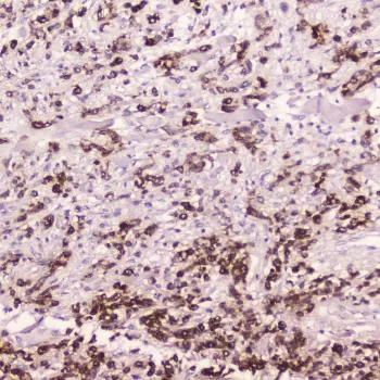 Cathepsin E Antibody / CTSE - image 1