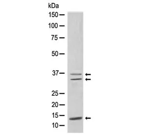 CEBPB Recombinant Antibody - image 1