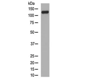 Collagen XVII Recombinant Antibody / COL17A1 - image 1