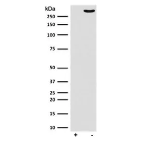 POLR2A Recombinant Antibody (pS2) - image 1