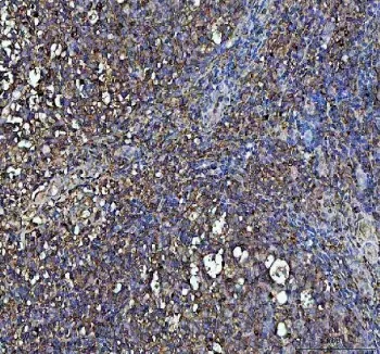 Interferon gamma Antibody / IFNG - image 1