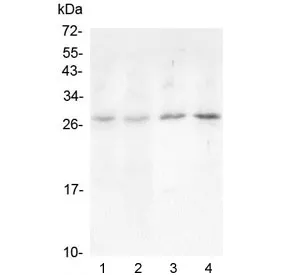 Oncostatin M Antibody / OSM - image 1