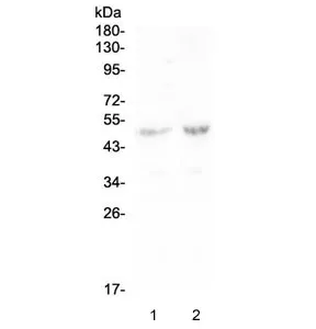 PLA2G7 Antibody / Lp-PLA2 / PAFAH - image 1