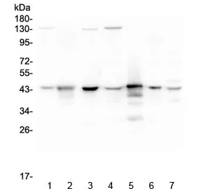 ADA Antibody / Adenosine deaminase - image 1
