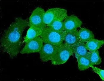 Beta-2 Microglobulin Antibody - image 1