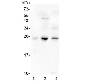Grancalcin Antibody / GCA - image 1