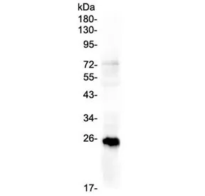 PLGF Antibody / PGF / Placenta Growth Factor - image 1