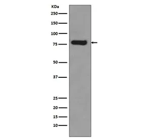 AR-V7 Recombinant Antibody / Androgen Receptor - image 1