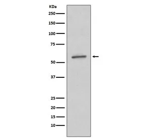 SGK1 Recombinant Antibody / SGK - image 1