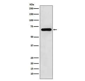 N-WASP Recombinant Antibody / Neural Wiskott-Aldrich syndrome protein - image 1