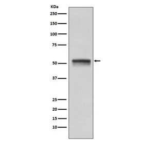 CHK1 Recombinant Antibody - image 1