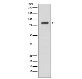 IKK beta Recombinant Antibody / IKBKB - image 1