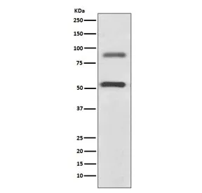 DCLK1 Recombinant Antibody / Doublecortin-like kinase 1 - image 1