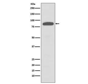 IKK alpha/beta Recombinant Antibody - image 1