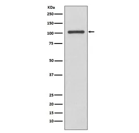 INPP4B Recombinant Antibody / Type II inositol 3,4-bisphosphate 4-phosphatase - image 1