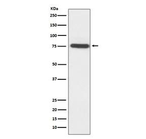TAK1 Recombinant Antibody / MAP3K7 - image 1