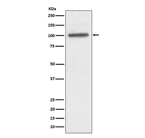 ACTN4 Recombinant Antibody / Alpha Actinin 4 - image 1