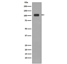 LSD1 Recombinant Antibody / Lysine-Specific Demethylase 1 - image 1