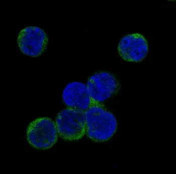 JAK2 Recombinant Antibody (pY1007/pY1008) - image 1