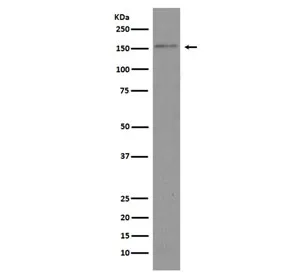 Brd4 Recombinant Antibody - image 1