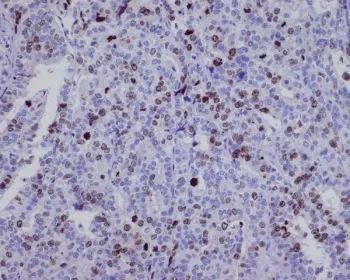 Survivin Recombinant Antibody / BIRC5 - image 1
