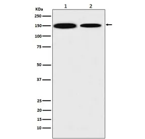 KDM4A Recombinant Antibody / JMJD2A - image 1