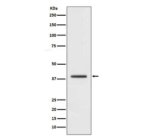 H2AFY Recombinant Antibody / Macro H2A.1 - image 1