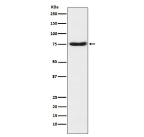 Netrin 1 Recombinant Antibody / NTN1 - image 1