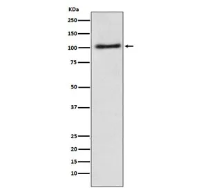 AP2A1 Recombinant Antibody / Alpha 1 adaptin - image 1