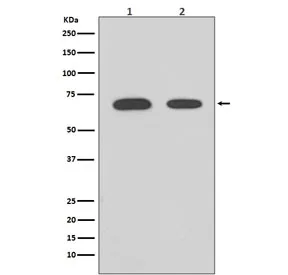 Chk2 Recombinant Antibody / CHEK2 - image 1