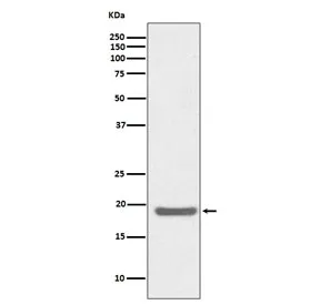 SOD1 Recombinant Antibody - image 1