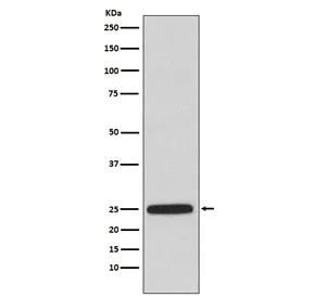 HPRT Recombinant Antibody - image 1