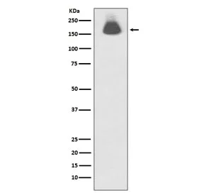 Phospho-EGF Receptor / EGFR Recombinant Antibody (pS695) - image 1