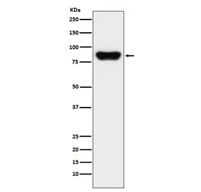 Prothrombin Recombinant Antibody - image 1