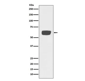 tPA Recombinant Antibody / Tissue Plasminogen Activator - image 1
