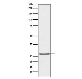 TIMP1 Recombinant Antibody - image 1