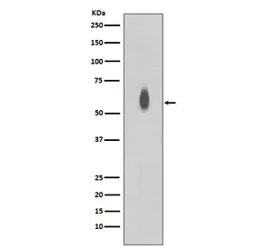 Phospho-c-Myc Recombinant Antibody (pT58 + pS62) - image 1