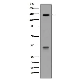 LDLR Recombinant Antibody / LDL Receptor - image 1