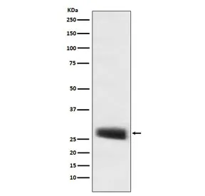 POMC Recombinant Antibody / ACTH - image 1